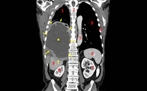 ONCOLOGY