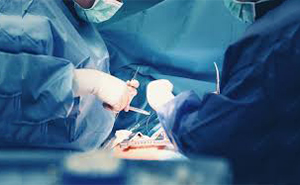 GENERAL SURGERY