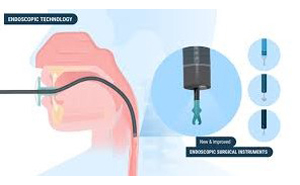 VIDEO ENDOSCOPY