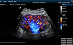 4D ULIRASONOGRAPHY