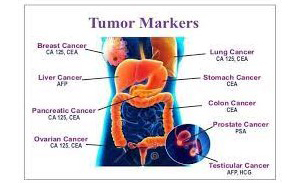 TUMOUR MARKERS