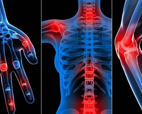 Rheumatology 