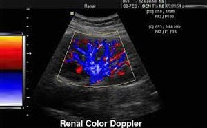 COLOR DOPPLER STUDY 